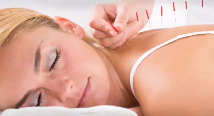 Akupunktur İle Kendinize İyi Bakın!