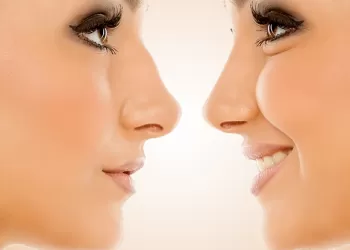 Burun Estetiği Sonrası Beslenme Önerileri