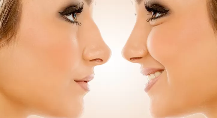 Burun Estetiği Sonrası Beslenme Önerileri