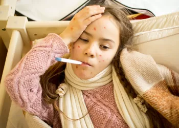 Kızamığa İyi Gelen 10 Besin