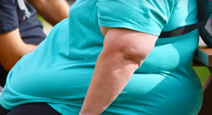 Obezite Nedir? Nedenleri Nelerdir?