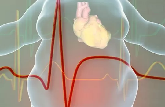 Obezitede Beslenme 1