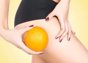 Selülit Nedir? Neden Oluşur? Nasıl Tedavi Edilir?