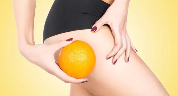 Selülit Nedir? Neden Oluşur? Nasıl Tedavi Edilir?