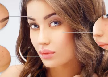 Sivilce Lekelerine Çözüm mü Arıyorsunuz? - Sivilceler İçin Bitkisel Maske Önerileri