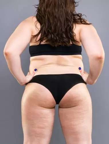 Bulancak Diyetisyenler