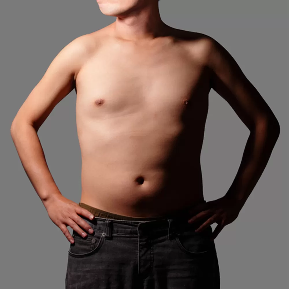 erkek zayıflama öncesi