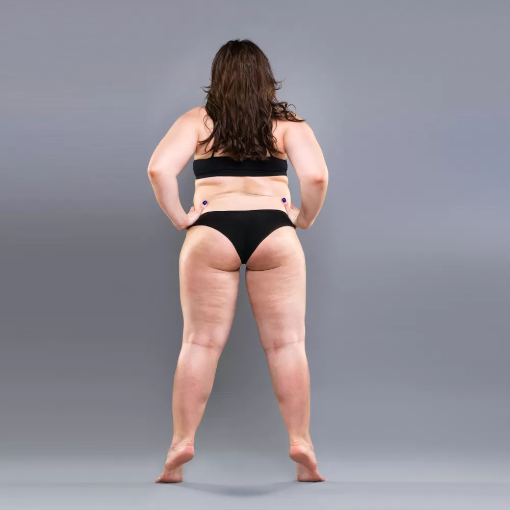 online diyet öncesi